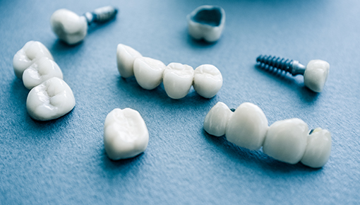Implantate - Zahnersatz - Zahnarztpraxis Dr. Jaensch
